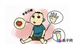 什么是手足口病？手足口病怎么治疗