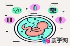 第二次四维彩超的最佳时间