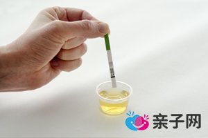 卵巢癌出现腹水是几期